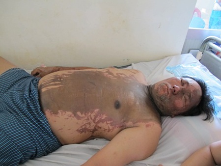 Nạn nhân Trần Văn Hùng