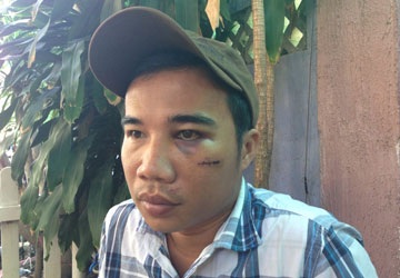 “Con tôi không lấy súng của tôi đi cướp” - 1 Nạn nhân Nguyễn Nhật Trường với thương tích trên người. Ảnh: VT