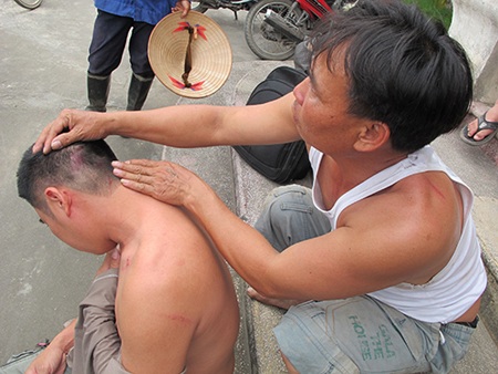 Vụ côn đồ đánh dân Tiên Lãng: Nhiều nhóm tham gia - 1 Một người dân xã Đại Thắng, huyện Tiên Lãng - Hải Phòng bị thương sau vụ hành hung