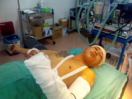 Nạn nhân đang được điều trị tại BV Đa Khoa tỉnh Kon Tum