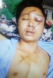 Nạn nhân Bùi Văn Phương.