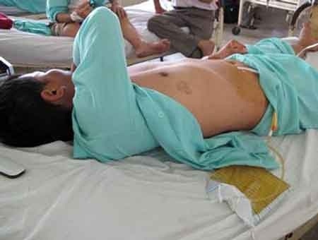 Một người đàn ông bị cắt của quý. Ảnh chỉ mang tính minh họa.