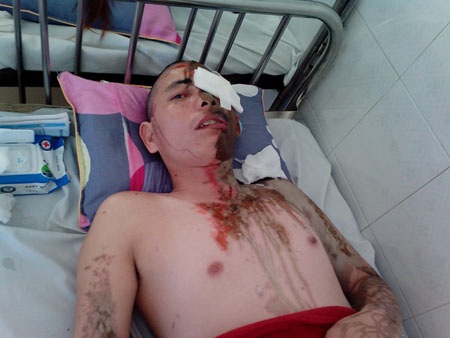 Anh Đại vẫn còn hoang mang khi nghĩ tới thảm cảnh tối hôm qua.