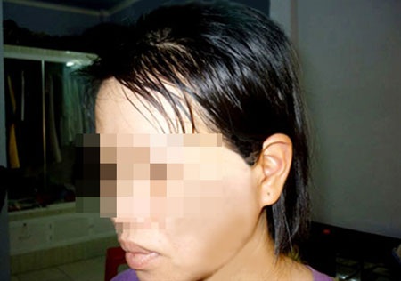 Chị Loan với mái tóc dài đã bị cắt nham nhở.