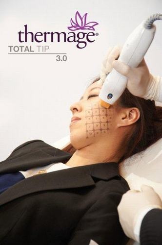 Phục hồi làn da tươi trẻ nhờ Thermage - 2 Trẻ hơn 10 tuổi với Thermage