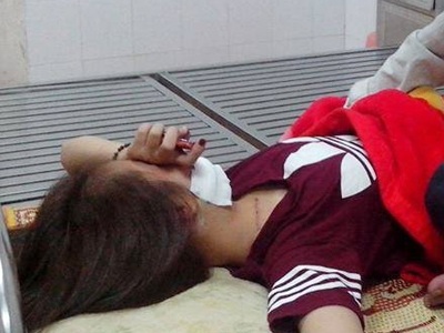 Nạn nhân Dung đang điều trị tại bệnh viện ngày 1/10.