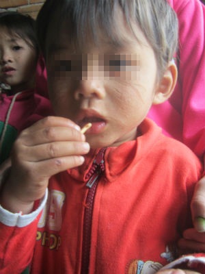 Khởi tố kẻ rạch mặt bé hàng xóm vì thấy giống chồng mình - 2 Cháu T.