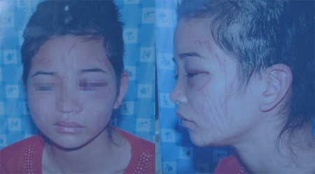 Tra tấn vợ dã man sau cú điện thoại lạc số - 1 Khuôn mặt chị Hường bị nhiều vết dao lam cứa và mái tóc dài bị cắt nham nhở.