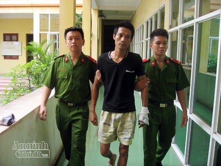 Bị "cắm sừng", ca sỹ phòng trà xử vợ bằng axit - 1 Danh cũng bị thương sau khi tạt axit vợ