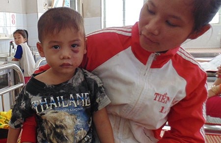 Bé trai ba tuổi bị cha dượng đánh dã man - 1 Cháu Nguyễn ở trung tâm y tế huyện. Ảnh: N.HOÀNG