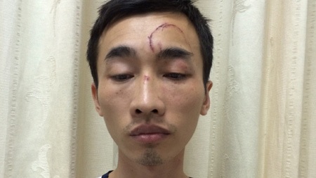 Hà Nội: Tống tiền bạn gái bằng “ảnh nóng” - 1 Đối tượng Trần Sỹ Nghiên