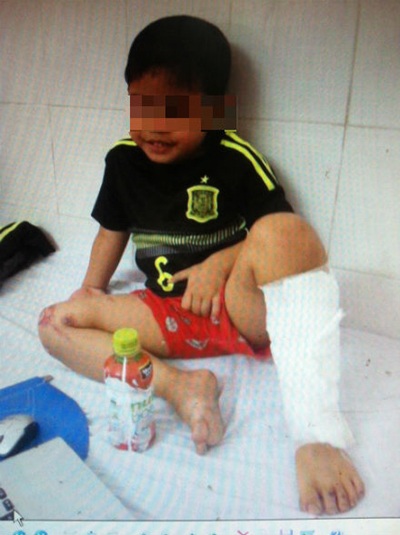 Cháu Nam đang điều trị tại bệnh viện