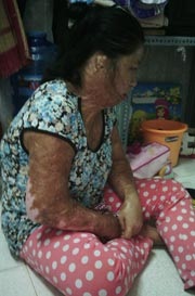 Được sống là niềm hạnh phúc, Nga đã không còn oán trách chồng nữa.