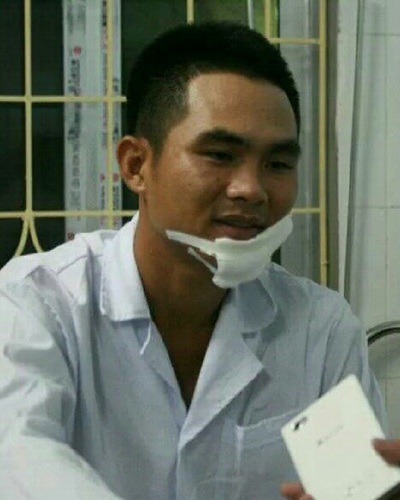 Thiếu úy Hiếu đang được điều trị tại bệnh viện.