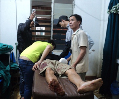 Bị chặn đánh giữa đường, nam thanh niên bị chém đứt lìa bàn tay - 2 Anh Hoàng lúc đang cấp cứu tại bệnh viện Đa khoa tỉnh Đắk Lắk