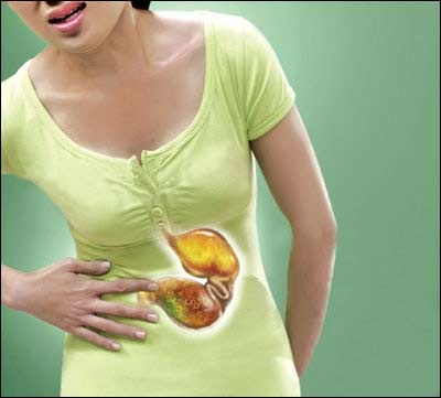 Xử trí khi bị chứng nóng dạ dày - 1 Xử trí khi bị chứng nóng dạ dày - 1