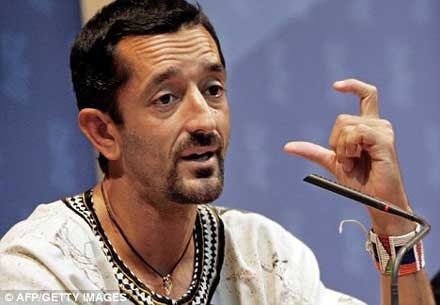 Trường hợp đầu tiên trên thế giới được ghép 2 chân - 2 Trường hợp đầu tiên trên thế giới được ghép 2 chân - 2