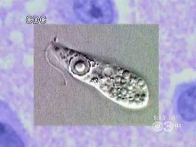 Loài amip ăn não đáng sợ