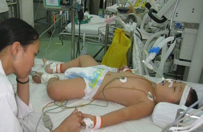 Căng thẳng, lo lắng vì bệnh tay chân miệng - 1