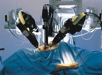 Ca ghép gan do rô-bốt thực hiện đầu tiên trên thế giới - 1 Ca ghép gan do rô-bốt thực hiện đầu tiên trên thế giới - 1