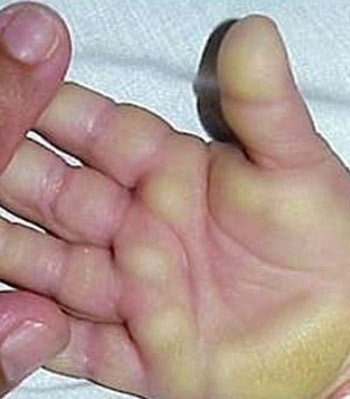 Quảng Ngãi: Xuất hiện dịch “bệnh lạ”  - 1