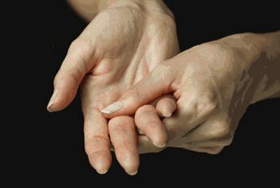 9 điều “thú vị” về viêm khớp dạng thấp - 1 9 điều “thú vị” về viêm khớp dạng thấp - 1