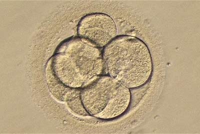 Thụ tinh trong ống nghiệm làm tăng nguy cơ biến chứng thai kỳ - 1