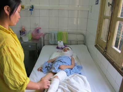 Rủ nhau đốt rượu chơi, trẻ bị bỏng nặng - 1 Rủ nhau đốt rượu chơi, trẻ bị bỏng nặng - 1