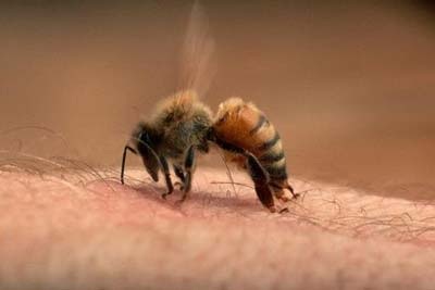 Khám phá thế giới của những con ong đốt và chứng kiến những người chịu đau khổ sự tấn công của chúng trong bức ảnh đặc biệt này!