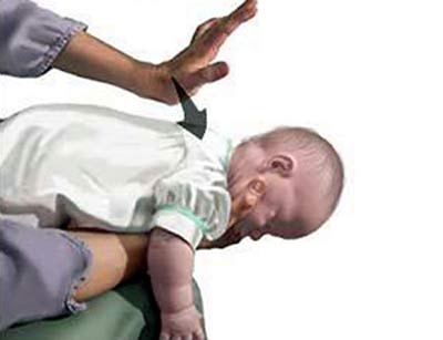 Sơ cứu trẻ nhỏ bị sặc cháo - 1 Sơ cứu trẻ nhỏ bị sặc cháo - 1