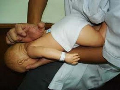 Sơ cứu trẻ nhỏ bị dị vật đường thở - 1 Sơ cứu trẻ nhỏ bị dị vật đường thở - 1