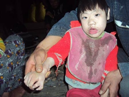 Bàng hoàng nỗi đau hôn nhân cận huyết - 2 Bàng hoàng nỗi đau hôn nhân cận huyết - 2