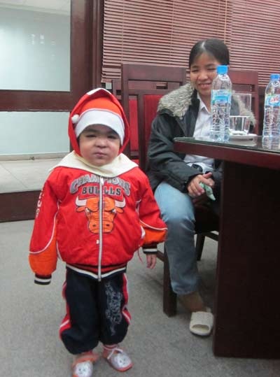 “Bỏng toàn thân bẩm sinh”: bé đầu tiên xuất viện, bé thứ 2 chuẩn bị được cứu - 3 “Bỏng toàn thân bẩm sinh”: bé đầu tiên xuất viện, bé thứ 2 chuẩn bị được cứu - 3