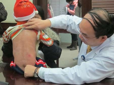 “Bỏng toàn thân bẩm sinh”: bé đầu tiên xuất viện, bé thứ 2 chuẩn bị được cứu - 1 “Bỏng toàn thân bẩm sinh”: bé đầu tiên xuất viện, bé thứ 2 chuẩn bị được cứu - 1