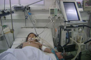 Cứu sống trẻ suy đa cơ quan do sốt xuất huyết - 1