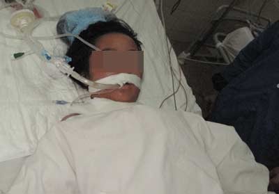 Sản phụ 14 tuổi nguy kịch vì... viêm răng - 1