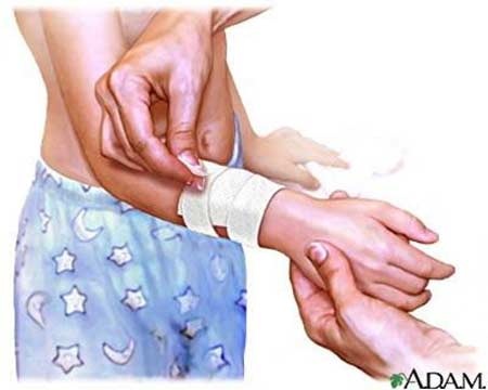 Nguyên tắc xử trí vết thương phần mềm chảy máu - 1 Nguyên tắc xử trí vết thương phần mềm chảy máu