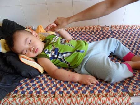 Đắk Lắk: Trời nắng nóng, trẻ nhập viện tăng mạnh - 2 Đắk Lắk: Trời nắng nóng, trẻ nhập viện tăng mạnh