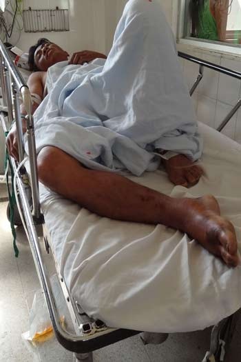 Cứu sống bệnh nhân bị rắn cắn đã ngưng tim - 1