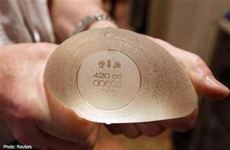 Cảnh báo tỉ lệ vỡ túi độn PIP tăng 7 lần - 1 Cảnh báo tỉ lệ vỡ túi độn PIP tăng 7 lần