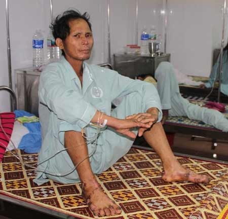 Điều trị bệnh “da lạ” không quá khó!