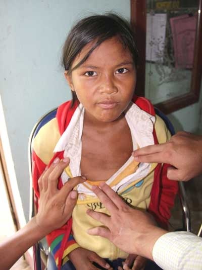 Quảng Ngãi: Bệnh “da dẻ tím tái” không nguy hiểm như bệnh “da lạ”? - 1 Quảng Ngãi: Bệnh “da dẻ tím tái” không nguy hiểm như bệnh “da lạ”?