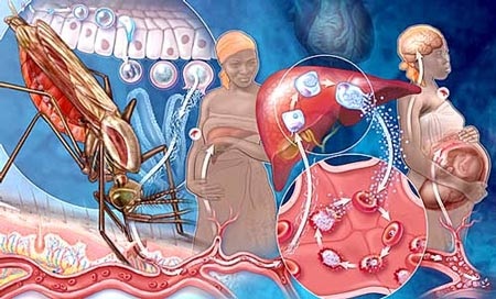 Mỗi phút có 1 trẻ tử vong vì sốt rét - 1 Mỗi phút có 1 trẻ tử vong vì sốt rét