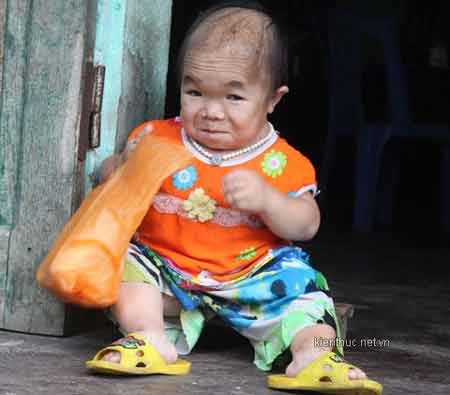 Cô gái 22 tuổi như trẻ lên... 3 - 1 Không ai ngờ, “em bé” này đã 22 tuổi.