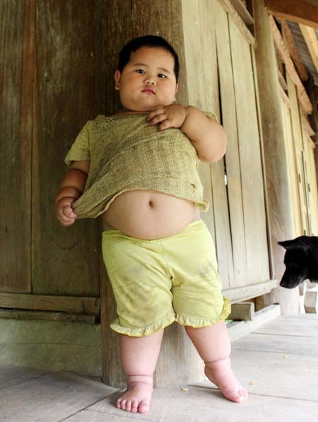 Cân nặng bé Hồng Anh thừa 120% so với chuẩn