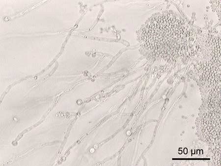 Nấm đường sinh dục - Thủ phạm gây tắc vòi trứng - 1 Candida albican