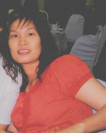 Ratphila Chairungki trước phẫu thuật