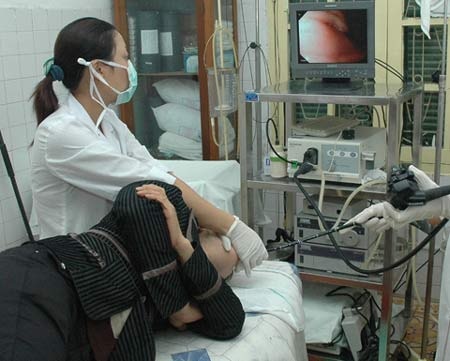 Loét dạ dày do uống giấm - 1 Ảnh minh họa