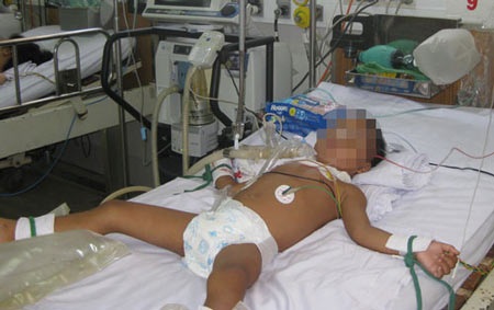 Bé 3 tuổi nguy kịch vì tiêm vắc-xin uốn ván không đủ liều - 1 Cháu Y. tiếp tục co giật do bệnh uốn ván