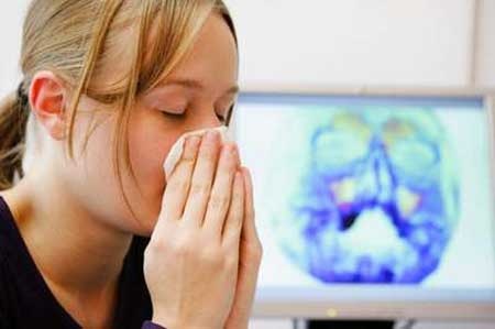 Viêm xoang, nguy hiểm không chỉ ở xoang! - 1 Viêm xoang, nguy hiểm không chỉ ở xoang!